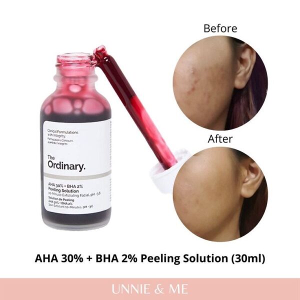 Ordinary AHA 30% + BHA 2% Peeling Solution (30ml) - Image 3